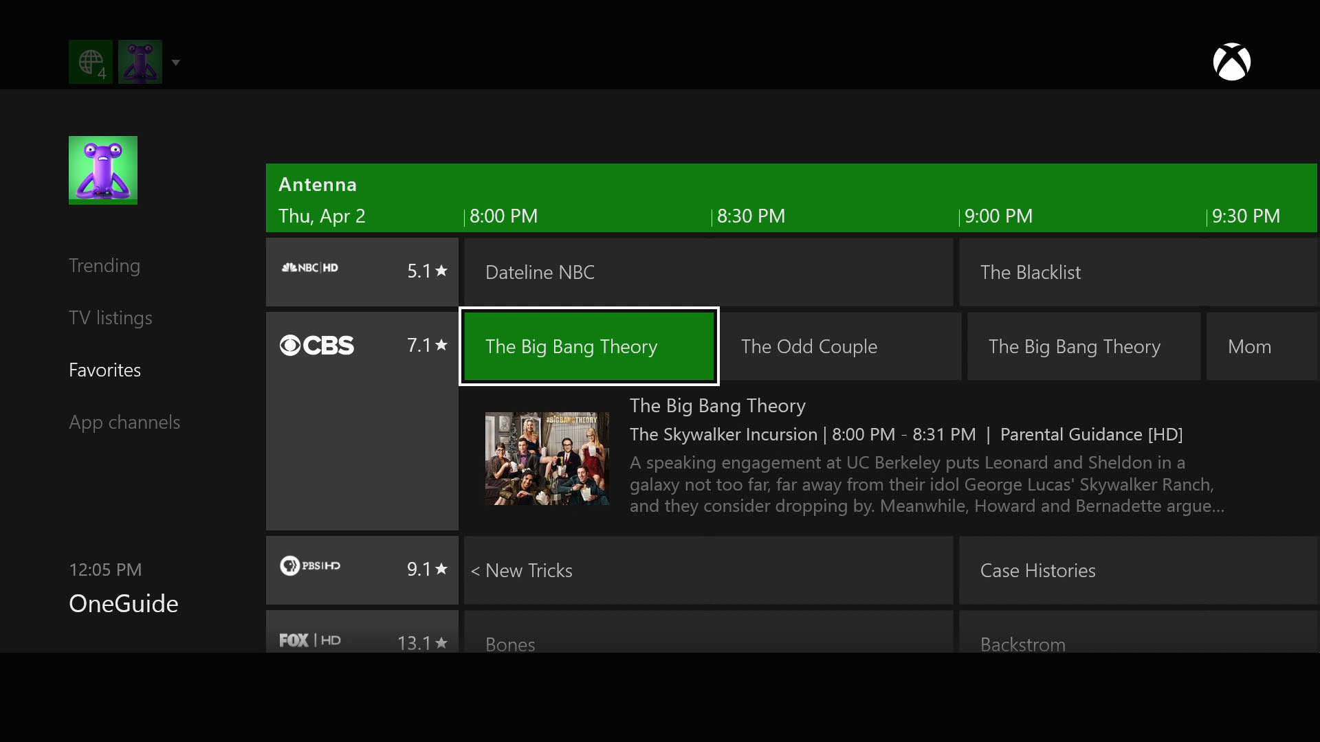 Hauppauge | Digital TV Tuner for Xbox One
